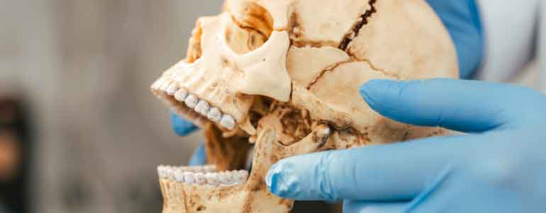 Terapia manual orofacial para alivio de migraña tensional en Polanco