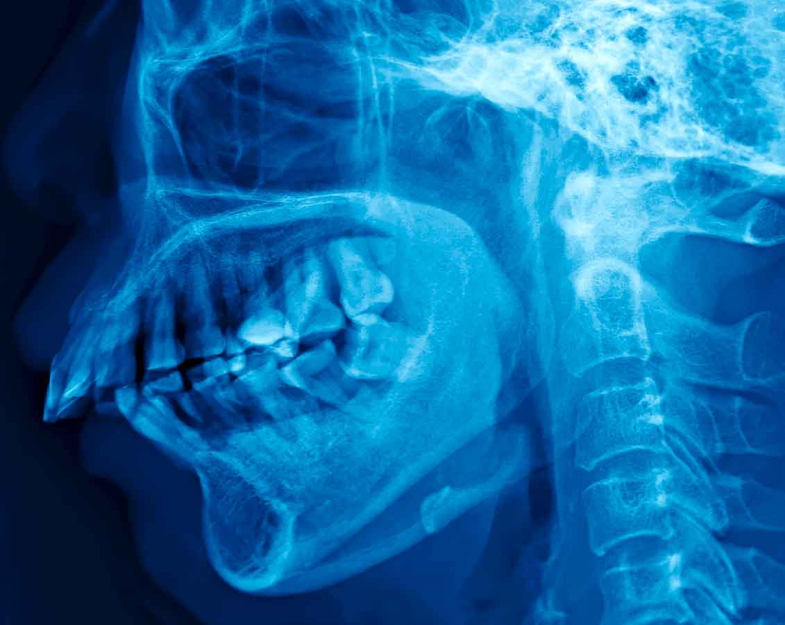 Artículo sobre tratamiento de la ATM y dolor mandibular